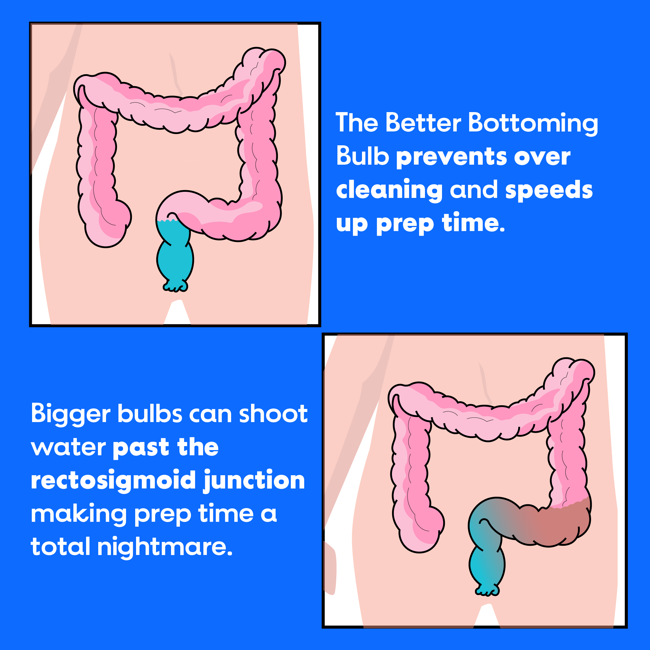 The Better Bottoming Bulb